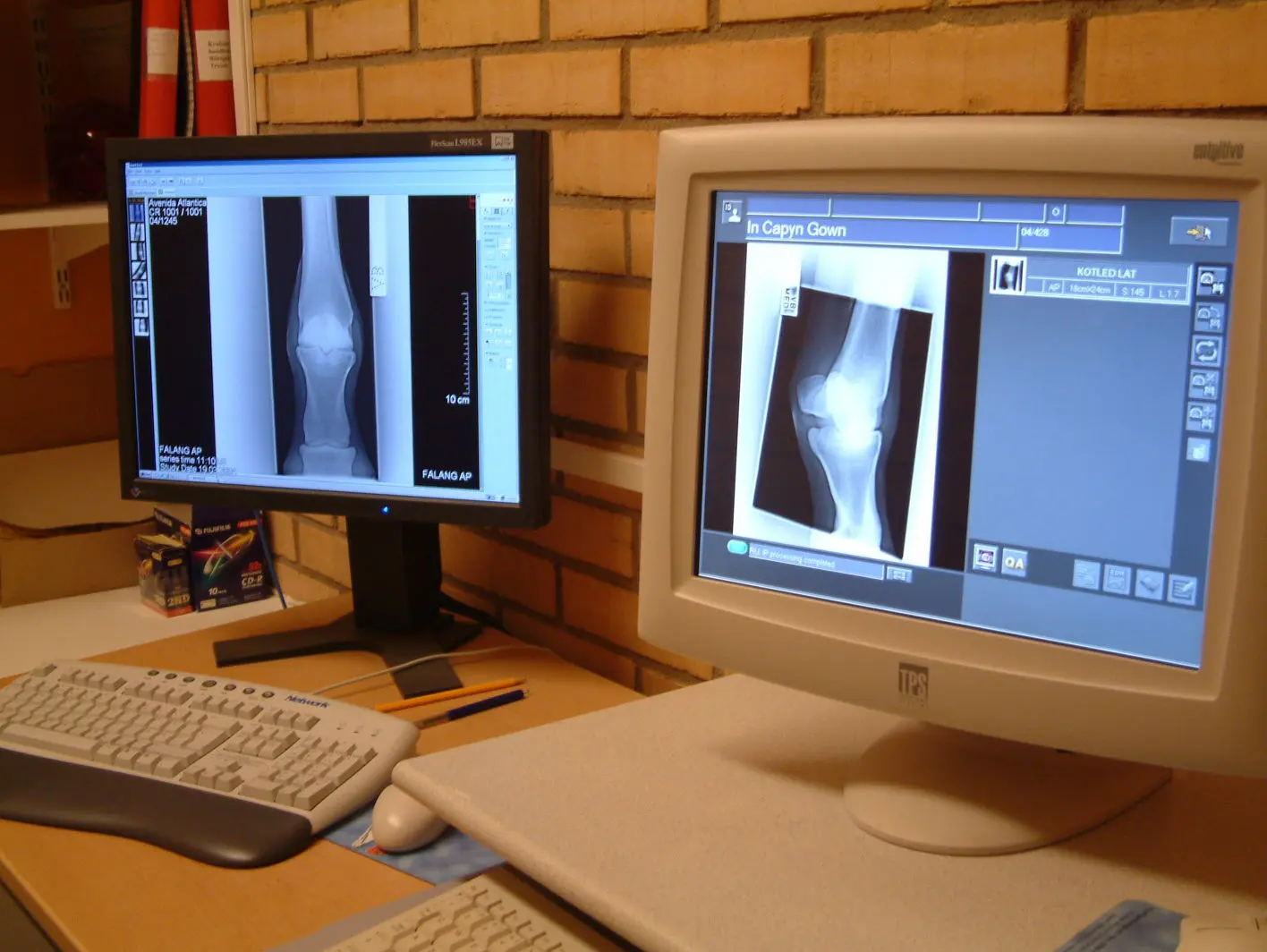 Digitalröntgen på Travbanekliniken.
